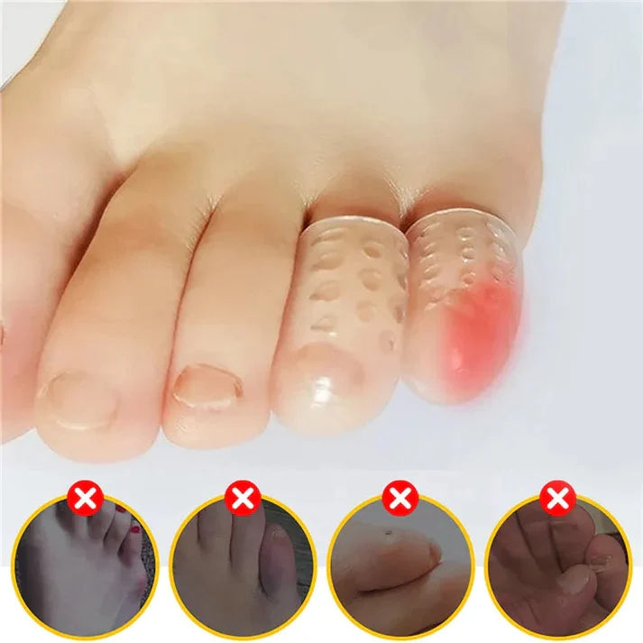 Silicone Anti-Toe Protector