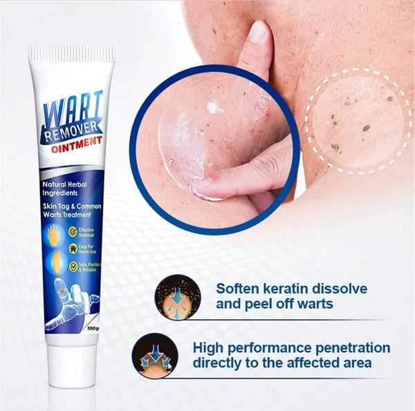 Instant Wart-Remover Ointment ( 100g )