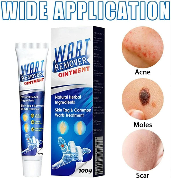 Instant Wart-Remover Ointment ( 100g )